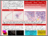 [thumbnail of Poster_CBIAS_Phenotype.pdf]